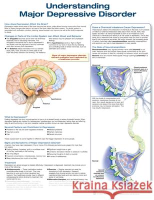 Understanding Depression Anatomical Chart Company   9781496384690 Lippincott Williams and Wilkins - książka