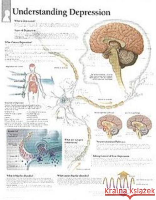 Understanding Depression Paper Poster Scientific Publishing 9781932922172 Scientific Publishing - książka