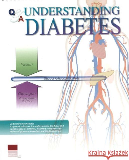 Understanding Diabetes Flip Chart Scientific Publishing 9781932922325 Scientific Publishing - książka