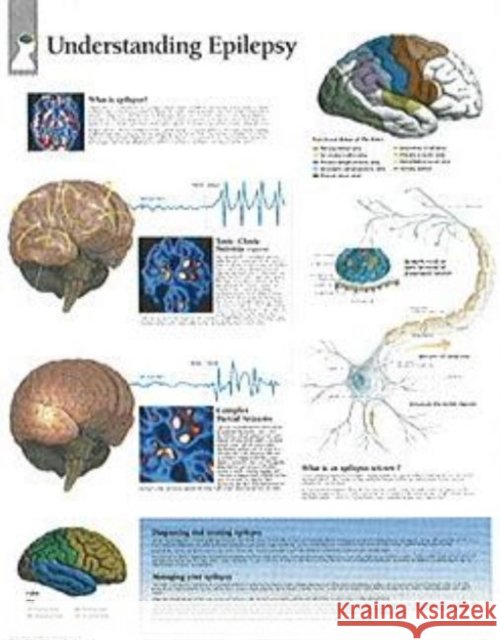Understanding Epilepsy Laminated Poster Scientific Publishing 9781932922226 Scientific Publishing - książka