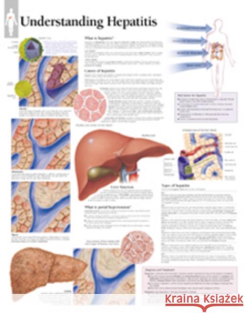 Understanding Hepatitis Laminated Poster Scientific Publishing 9781930633858 Scientific Publishing Limited - książka
