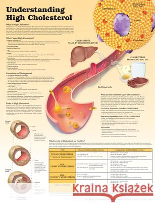 Understanding High Cholesterol Lam Anatomical Chart Company Douglas S. Moodie  9781451193244 Lippincott Williams and Wilkins - książka