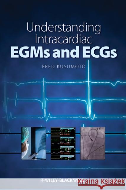 Understanding Intracardiac EGMs and ECGs Fred Kusumoto Kusumoto 9781405184106 Wiley-Blackwell - książka