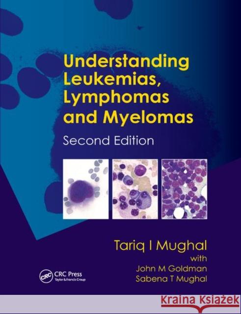 Understanding Leukemias, Lymphomas and Myelomas Tariq I. Mughal Tariq Mughal John Goldman 9780367384883 CRC Press - książka