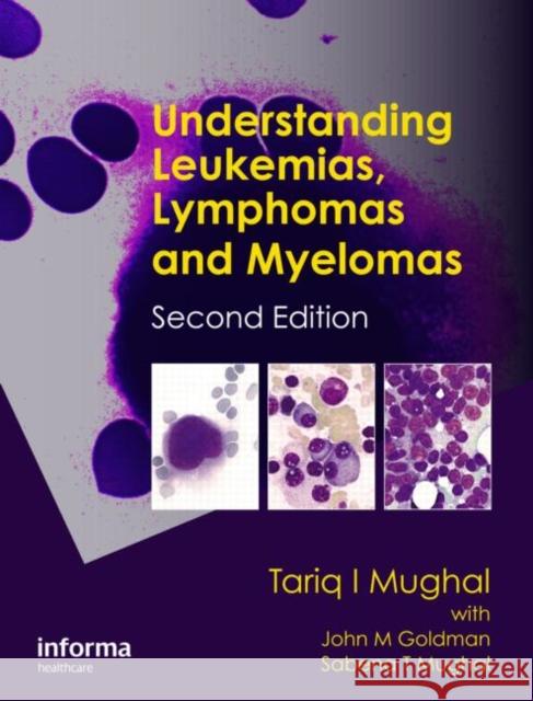 Understanding Leukemias, Lymphomas and Myelomas Tariq I. Mughal 9781841847757 CRC Press - książka