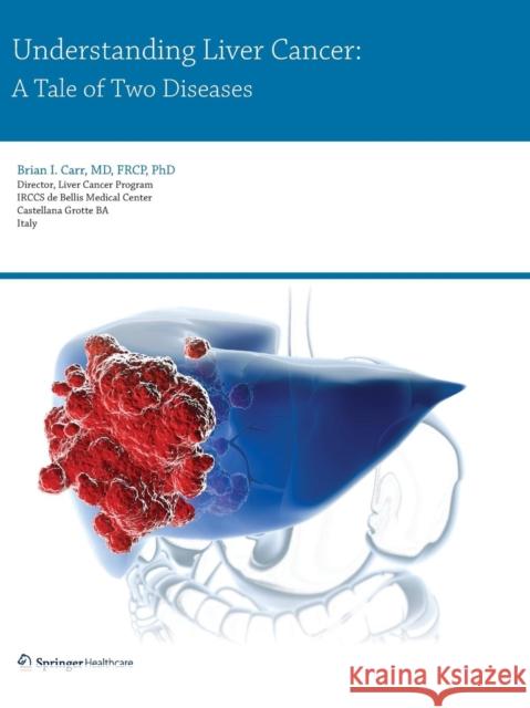 Understanding Liver Cancer: A Tale of Two Diseases Carr, Brian I. 9781910315019 Springer Healthcare - książka