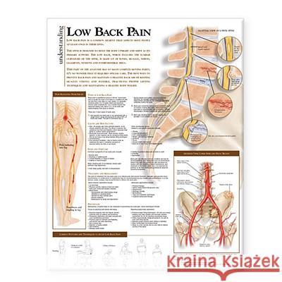 Understanding Low Back Pain Anatomical Chart  Anatomical Chart Company 9780781782432  - książka