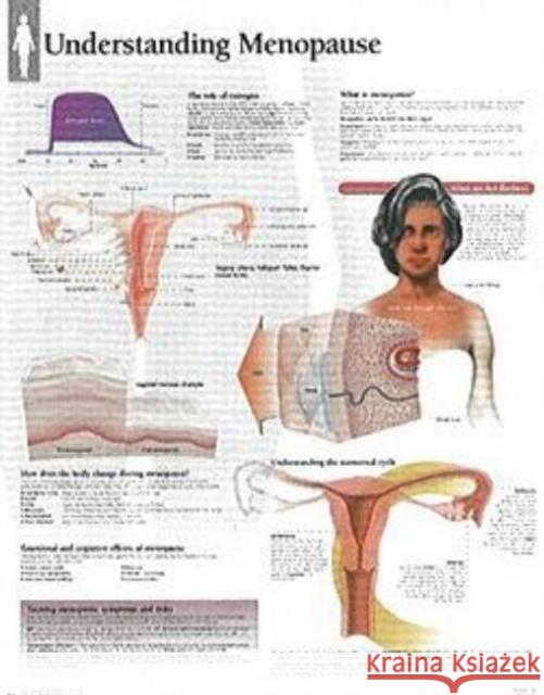 Understanding Menopause Laminated Poster Scientific Publishing 9781930633612 Scientific Publishing Limited - książka