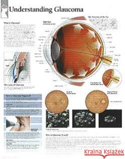 Understanding Menopause Paper Poster Scientific Publishing 9781930633605 Scientific Publishing Limited - książka