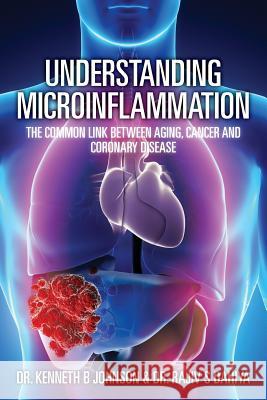 Understanding Microinflammation: The Common Link Between Aging, Cancer and Coronary Disease Dr Kenneth B. Johnson Dr Rajiv S. Dahiya 9781482735383 Createspace - książka