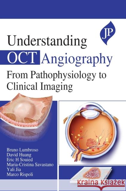 Understanding OCT Angiography Bruno Lumbroso David Huang Eric H Souied 9781909836938 JP Medical Ltd - książka