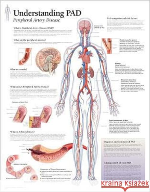 Understanding PAD Paper Poster Scientific Publishing 9781932922493 Scientific Publishing - książka