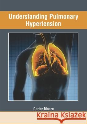 Understanding Pulmonary Hypertension Carter Moore 9781632428011 Foster Academics - książka