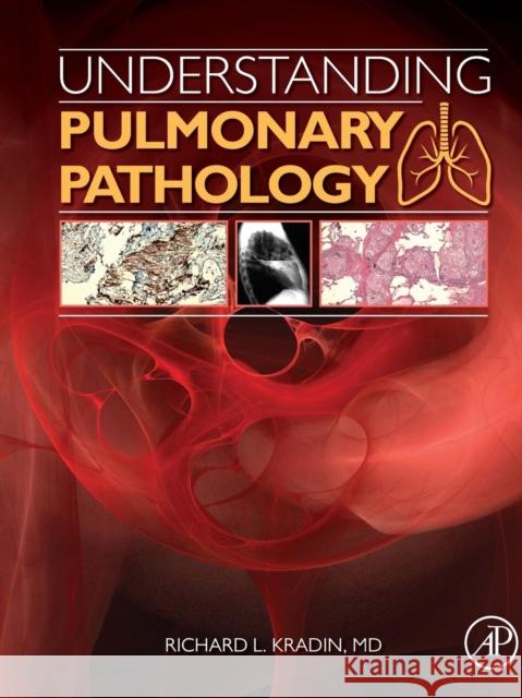 Understanding Pulmonary Pathology: Applying Pathological Findings in Therapeutic Decision Making Richard L. Kradin 9780128013045 Academic Press - książka