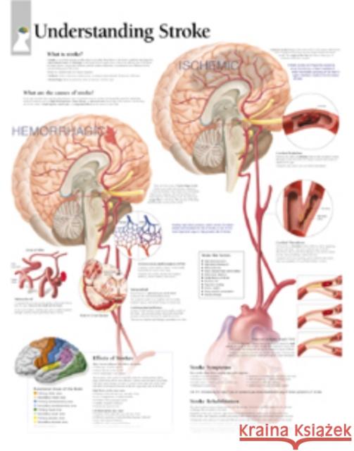 Understanding Stroke Laminated Poster Scientific Publishing 9781930633490 Scientific Publishing Limited - książka