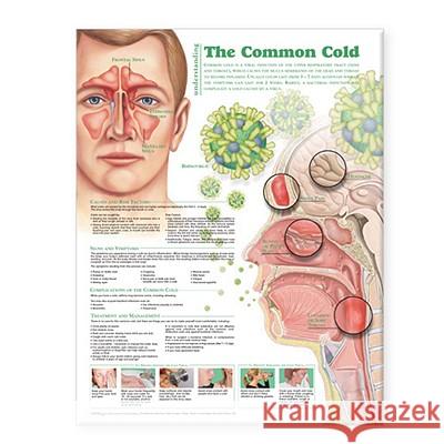 Understanding the Common Cold Anatomical Chart Anatomical Chart Company 9780781786300 Lippincott Williams & Wilkins - książka