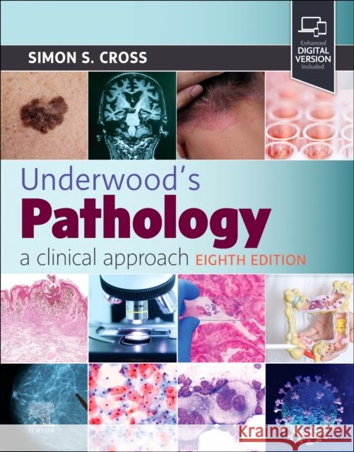Underwood's Pathology: A Clinical Approach Simon S. Cross 9780443116995 Elsevier - książka