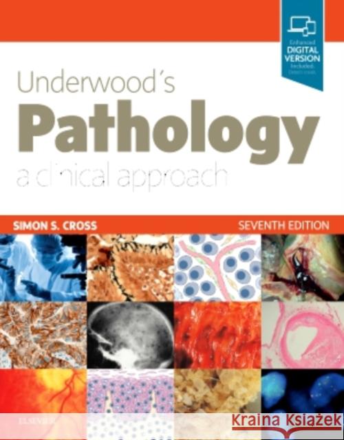 Underwood's Pathology: A Clinical Approach Cross, Simon 9780702072123 Elsevier Health Sciences - książka