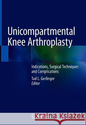 Unicompartmental Knee Arthroplasty: Indications, Surgical Techniques and Complications Gerlinger, Tad L. 9783030274108 Springer - książka