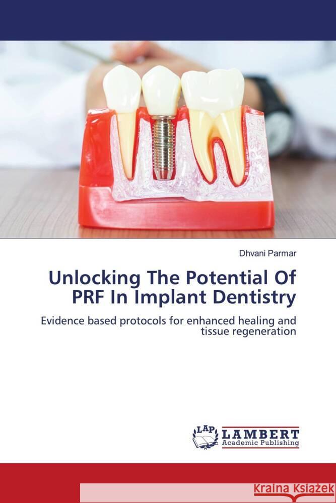 Unlocking The Potential Of PRF In Implant Dentistry Parmar, Dhvani 9786208435035 LAP Lambert Academic Publishing - książka