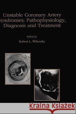 Unstable Coronary Artery Syndromes Pathophysiology, Diagnosis and Treatment Robert L. Wilensky 9780792382010 Kluwer Academic Publishers - książka