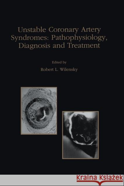 Unstable Coronary Artery Syndromes Pathophysiology, Diagnosis and Treatment Robert L. Wilensky 9781461376170 Springer - książka