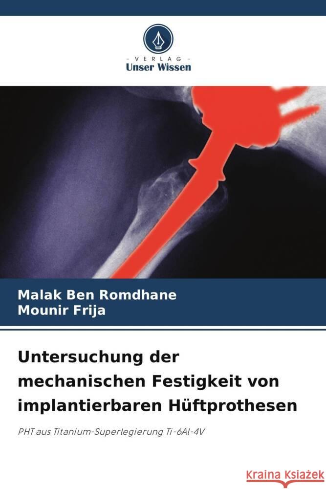 Untersuchung der mechanischen Festigkeit von implantierbaren Hüftprothesen Ben Romdhane, Malak, Frija, Mounir 9786208285371 Verlag Unser Wissen - książka