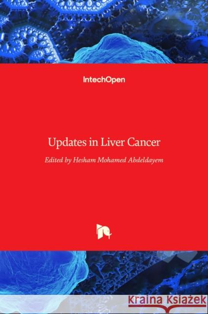 Updates in Liver Cancer Hesham Mohamed Abdeldayem 9789535130635 Intechopen - książka