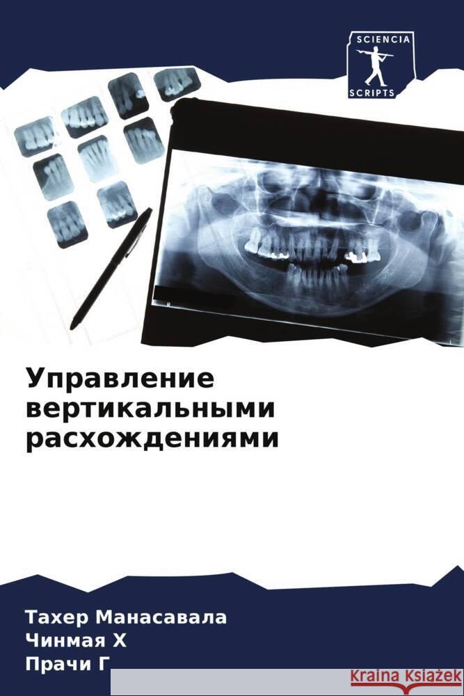 Uprawlenie wertikal'nymi rashozhdeniqmi MANASAVALA, TAHER, H, Chinmaq, G, Prachi 9786204467818 Sciencia Scripts - książka