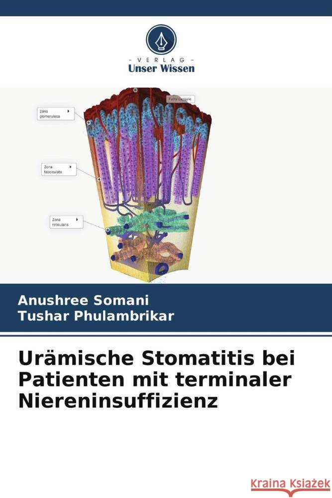 Ur?mische Stomatitis bei Patienten mit terminaler Niereninsuffizienz Anushree Somani Tushar Phulambrikar 9786207336838 Verlag Unser Wissen - książka