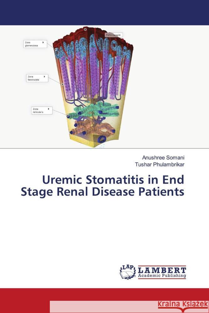 Uremic Stomatitis in End Stage Renal Disease Patients Somani, Anushree, PHULAMBRIKAR, TUSHAR 9786206183068 LAP Lambert Academic Publishing - książka