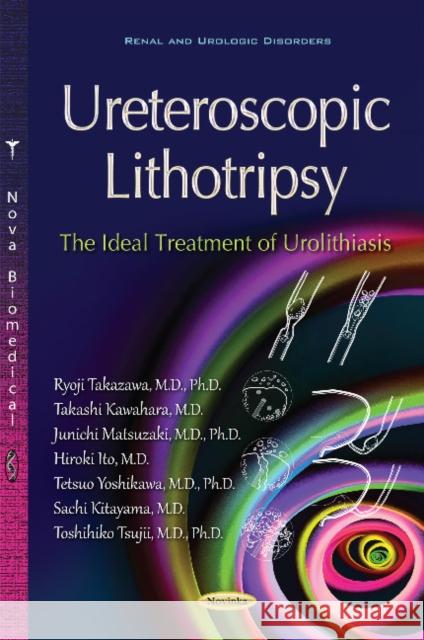 Ureteroscopic Lithotripsy: The Ideal Treatment of Urolithiasis Ryoji Takazawa, Sachi Kitayama, Toshihiko Tsujii, Junichi Matsuzaki 9781631179228 Nova Science Publishers Inc - książka