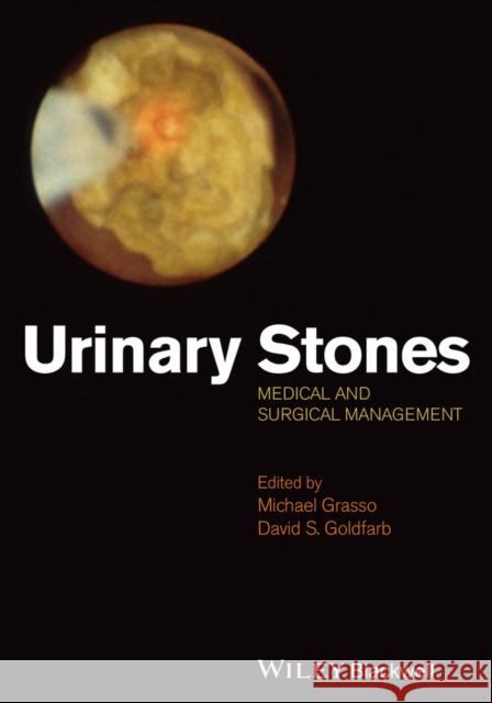Urinary Stones: Medical and Surgical Management Grasso, Michael 9781118405437 John Wiley & Sons - książka