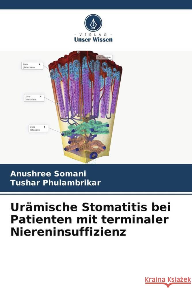 Ur?mische Stomatitis bei Patienten mit terminaler Niereninsuffizienz Anushree Somani Tushar Phulambrikar 9786207336838 Verlag Unser Wissen - książka