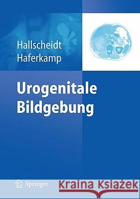 Urogenitale Bildgebung Hallscheidt, Peter Haferkamp, Axel  9783642105258 Springer, Berlin - książka
