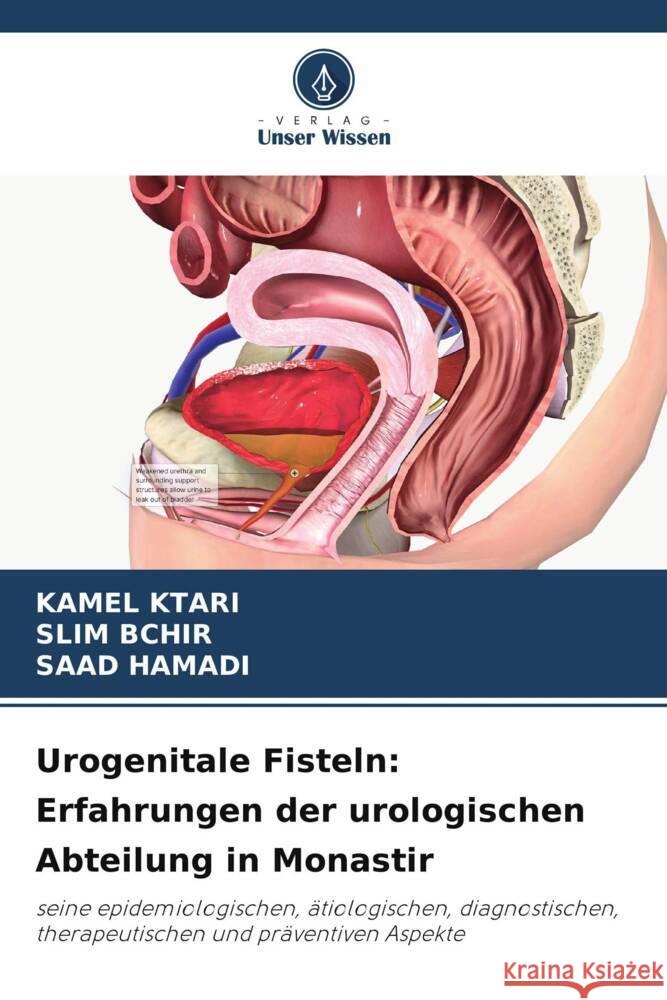 Urogenitale Fisteln: Erfahrungen der urologischen Abteilung in Monastir Ktari, Kamel, BCHIR, SLIM, HAMADI, SAAD 9786206521129 Verlag Unser Wissen - książka