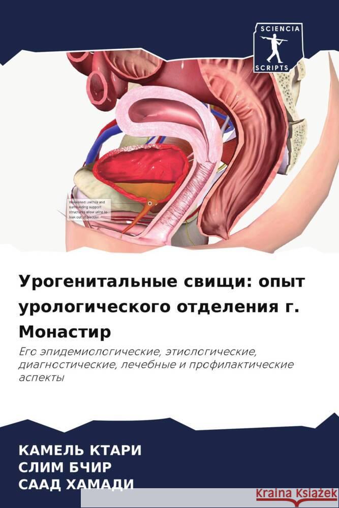 Urogenital'nye swischi: opyt urologicheskogo otdeleniq g. Monastir Ktari, Kamel', BCHIR, SLIM, HAMADI, SAAD 9786206521174 Sciencia Scripts - książka