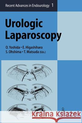 Urologic Laparoscopy Osamu Yoshida Eiji Higashihara Shinichi Ohshima 9784431659006 Springer - książka