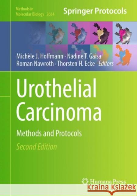 Urothelial Carcinoma: Methods and Protocols Mich?le J. Hoffmann Nadine T. Gaisa Roman Nawroth 9781071632901 Humana - książka