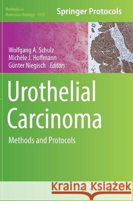 Urothelial Carcinoma: Methods and Protocols Schulz, Wolfgang A. 9781493972333 Humana Press - książka