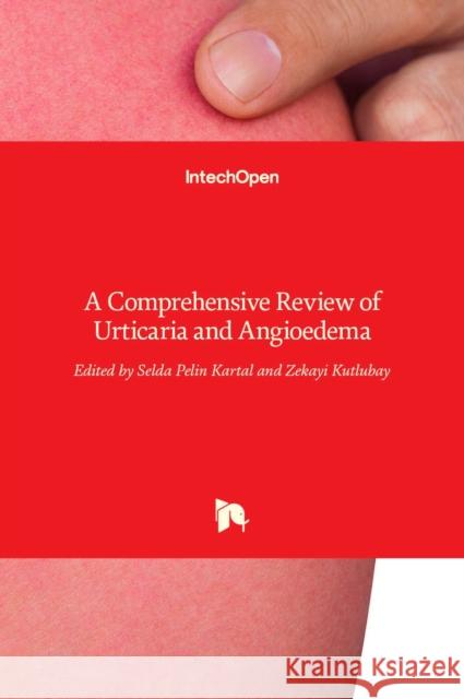 Urticaria and Angioedema: A Comprehensive Review of Selda Pelin Kartal Zekayi Kutlubay 9789535131670 Intechopen - książka