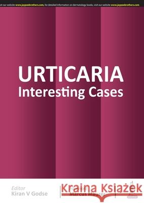 Urticaria: Interesting Cases Kiran V Godse   9789389587494 Jaypee Brothers Medical Publishers - książka