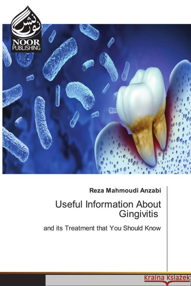 Useful Information About Gingivitis Reza Mahmoudi Anzabi 9786205634523 Noor Publishing - książka