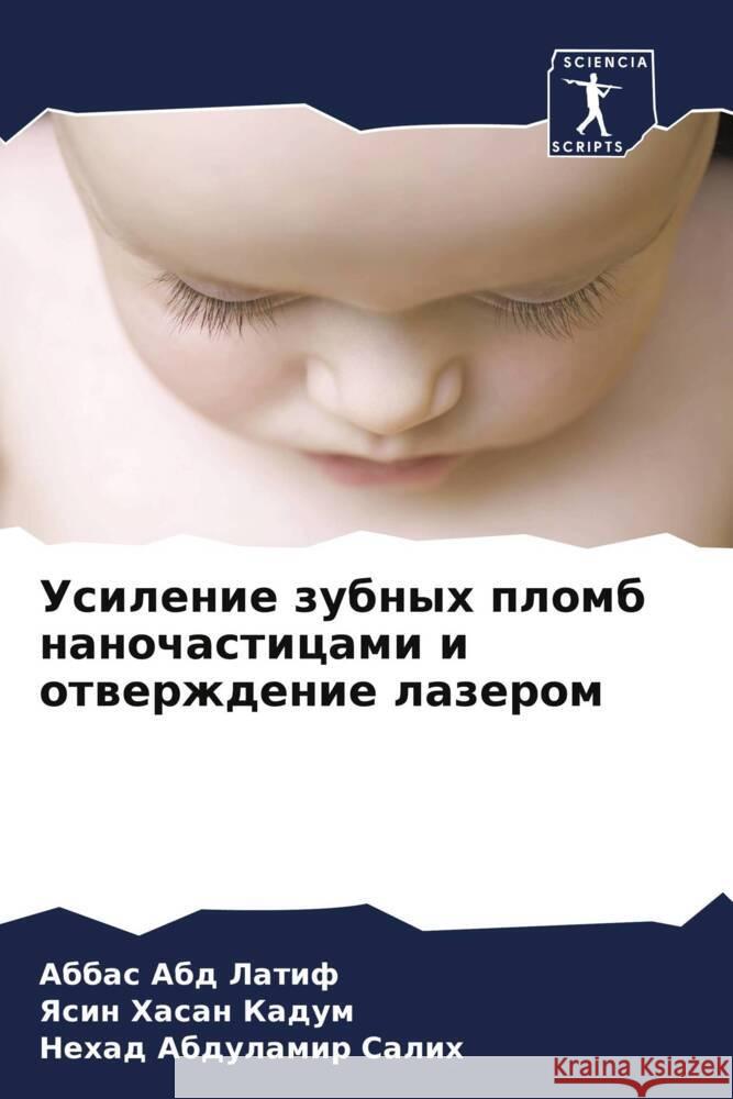 Usilenie zubnyh plomb nanochasticami i otwerzhdenie lazerom Abd Latif, Abbas, Hasan Kadum, Yasin, Abdulamir Salih, Nehad 9786206504962 Sciencia Scripts - książka