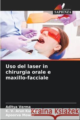 Uso del laser in chirurgia orale e maxillo-facciale Aditya Verma K. V. Aru Apoorva Mowar 9786207745036 Edizioni Sapienza - książka