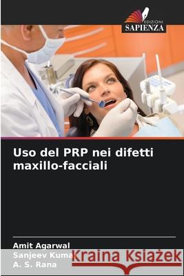 Uso del PRP nei difetti maxillo-facciali Amit Agarwal Sanjeev Kumar A. S. Rana 9786207931064 Edizioni Sapienza - książka