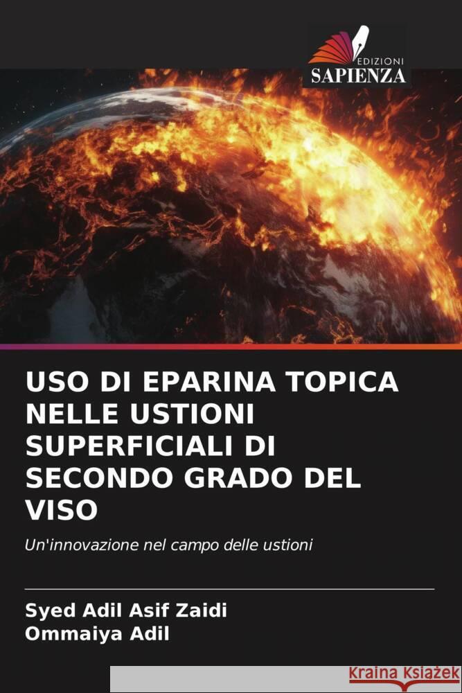 USO DI EPARINA TOPICA NELLE USTIONI SUPERFICIALI DI SECONDO GRADO DEL VISO Asif Zaidi, Syed Adil, Adil, Ommaiya 9786206627104 Edizioni Sapienza - książka