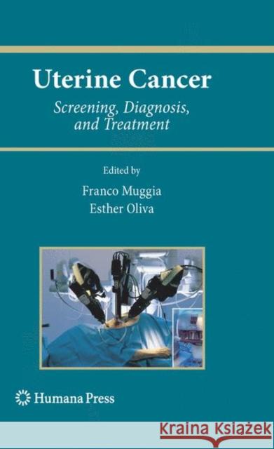 Uterine Cancer: Screening, Diagnosis, and Treatment Muggia, Franco 9781588297365 Humana Press - książka