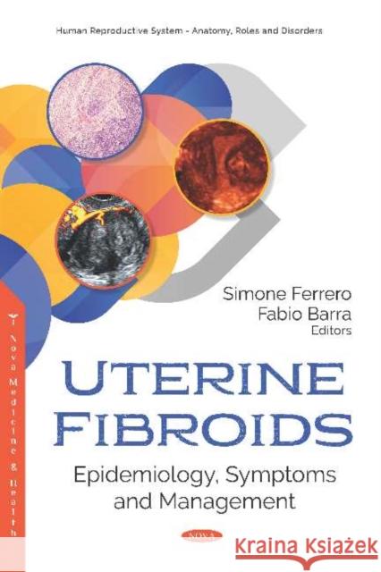 Uterine Fibroids: Epidemiology, Symptoms and Management: Epidemiology, Symptoms and Management Simone Ferrero, M.D., Ph.D. Fabio Barra, M.D.  9781536150469 Nova Science Publishers Inc - książka
