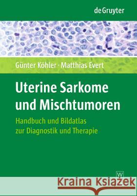 Uterine Sarkome und Mischtumoren: Handbuch und Bildatlas zur Diagnostik und Therapie Günter Köhler, Matthias Evert 9783110213805 De Gruyter - książka